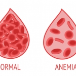 Tips Mencegah Anemia Pada Remaja. Foto: Ist