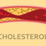 Benarkah Aktivitas Fisik Bisa Turunkan Kolesterol Jahat? Ini Penjelasannya. Foto: Ist