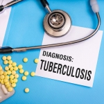 Ketahui 8 Gejala Awal Penyakit TBC. Foto: Ist