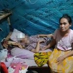Korban dengan kondisi masih diperban dan terbaring di tempat tidurnya setelah menjadi korban pengeroyokan di dekat SPBU depan Puri Surya Jaya, Gedangan.