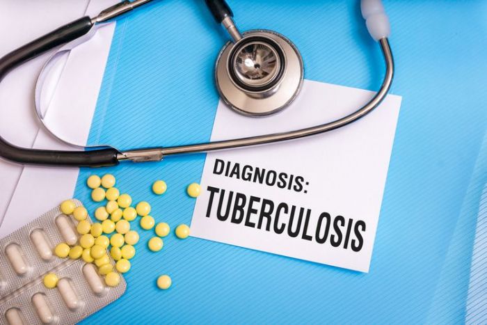 Ketahui 8 Gejala Awal Penyakit TBC