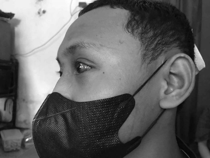 Kembali Berulah, Gangster di Sidoarjo Keroyok Remaja hingga Babak Belur