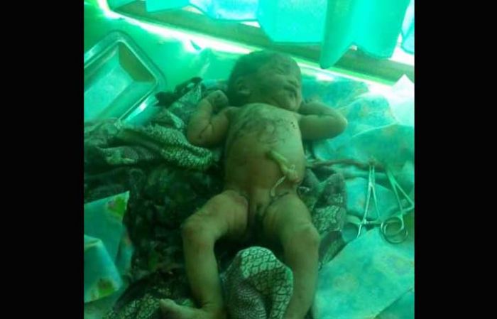 Dikira Ular, Ternyata yang Terbungkus Daun Jati Ini Bayi Perempuan