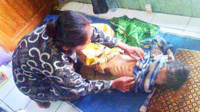 Ali Fahmi si Bocah Penderita Gizi Buruk di Sampang, Dinkes Lepas Tanggung Jawab