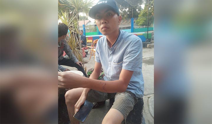 Korban pembacokan menunjukkan sejumlah bekas luka yang didapatnya usai diserang pelaku.