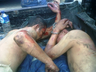 ?

Kedua jambret yang babak belur dihajar massa. Foto:gogon/BANGSAONLINE