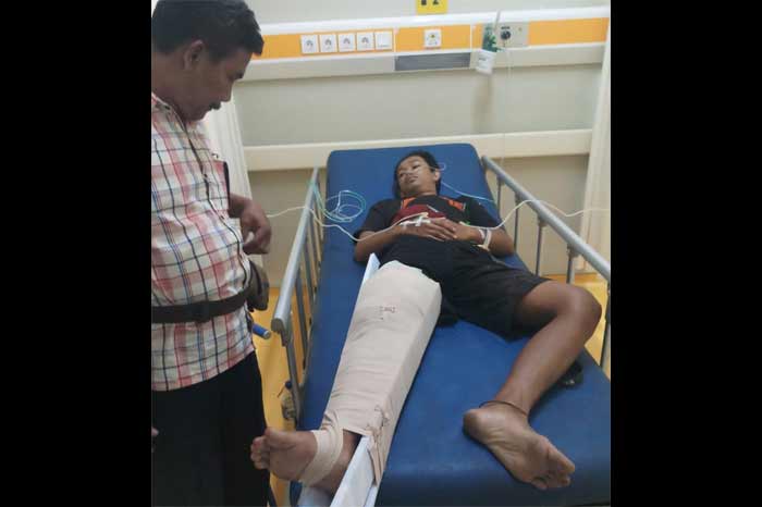 Rifqi, salah satu korban pelemparan bondet. foto: SUPARDI/ BANGSAONLINE