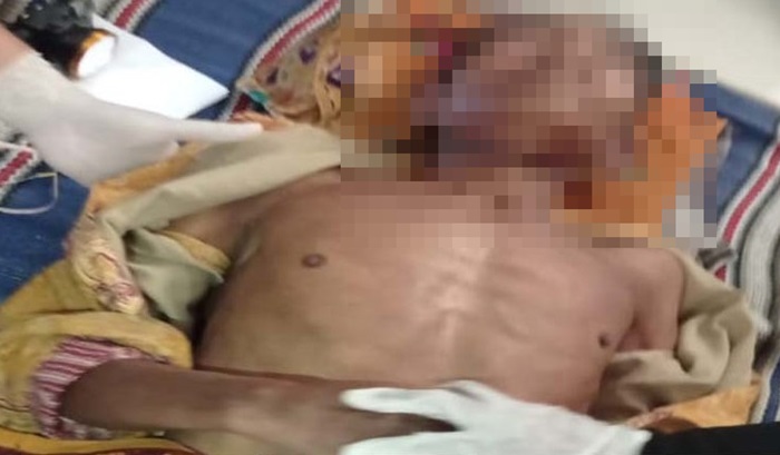 Kakek 73 Tahun di Sumenep Akhiri Hidup dengan Gantung Diri