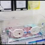 Bayi yang dibuang orang tuanya saat mendapat perawatan intensif di rumah sakit.