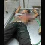 KEOK: Salah satu bandit saat di kamar mayat RSUD dr. Soetomo untuk dilakukan autopsi. foto: hb