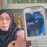 Orang tua Gladys menunjukan foto luka anaknya yang dipukul oleh guru olahraganya.