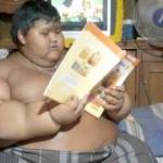 Arya Permana bocah 10 tahun pengidap Severely Obese.