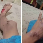 Korban pembacokan gangster di Surabaya.