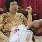 TERLUKA: Wajah Maria terlihat bengkak dan berdarah setelah mengaku dianiya kekasihnya. foto: khumaidi/BANGSAONLINE