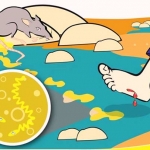 Ilustrasi leptospirosis.