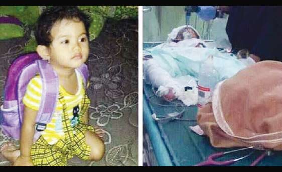 Intan Olovia Banjarnahor (2,5 tahun) saat dalam perawatan rumah sakit sebelum akhirnya meninggal.