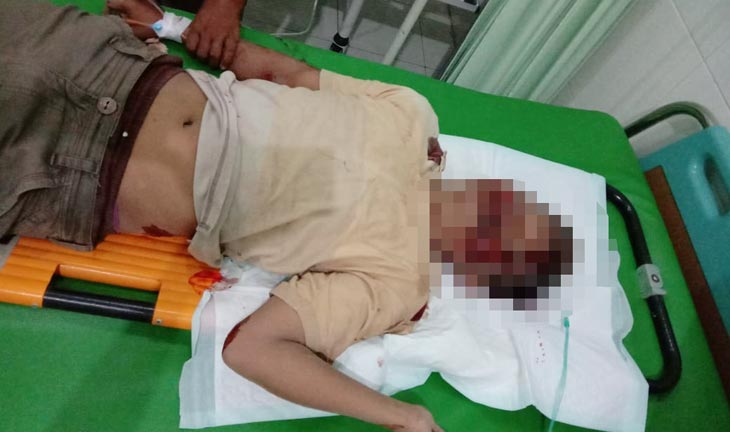 Kondisi korban usai mengalami kecelakaan tunggal di jalan Poros Kecamatan Kerek menuju Montong, Minggu (16/2) dini hari.