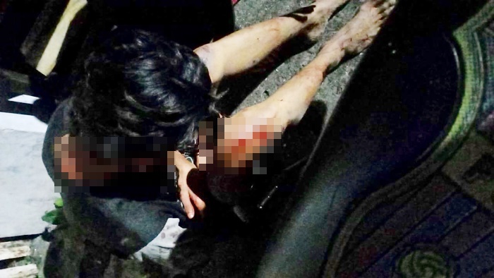 Korban mengalami pendarahan setelah dibacok dan sepeda motornya raib dirampas oleh gerombolan pemuda dengan memakai sepeda motor.