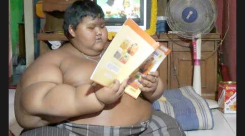 Arya Permana bocah 10 tahun pengidap Severely Obese.
