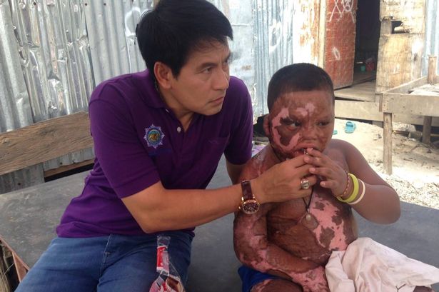 Mr Bhin bersama si bocah. foto: mirror.co.uk