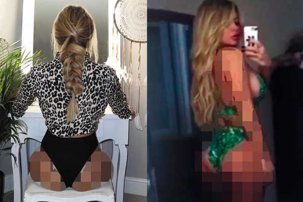 Menderita Sindrom Dysmorphia, Bokong Bianca Gascoigne Dipermak Jadi Bulat Berisi