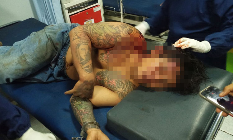 Salah satu pelaku jambret saat mendapat perawatan di Puskesmas Prambon.