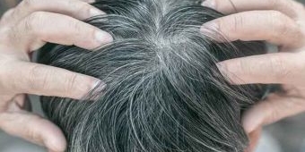 Usia Muda Tapi Rambut Sudah Beruban? Ini Makanan untuk Cegah Ubanan