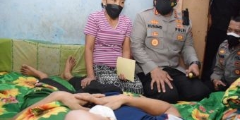 Prihatin, Kapolresta Sidoarjo Jenguk Warga Penderita Tumor Mata di Krian