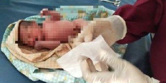 Penemu Bayi Dibungkus Daun Pisang di Blitar Ternyata Ibu Kandungnya Sendiri