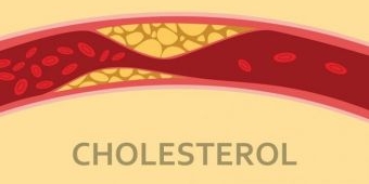 Benarkah Aktivitas Fisik Bisa Turunkan Kolesterol Jahat? Ini Penjelasannya