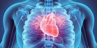 Cara Mencegah Penyumbatan Setelah Pasang Ring Jantung