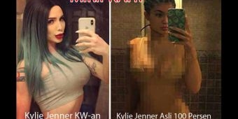 Ingin Mirip Kylie Jenner, Banci Ini Habiskan Uang Nyaris Rp 1 M, Tapi Organ Vital Ogah Dipotong