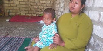 Kisah Nazril, Balita 2 Tahun Asal Bojonegoro yang Bertahan Hidup Menggunakan Kateter