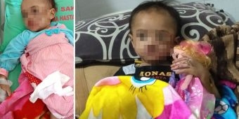 Bayi 2,5 Tahun di Kota Batu Dianiaya Calon Suami Ibunya: Disiram Minyak Panas, Dipukul, Bibir Sobek