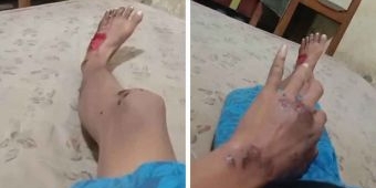 Gangster Bacok Jukir di Surabaya, Polisi Belum Terima Laporan