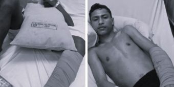 Korban Pembacokan di Kota Lama Surabaya Belum Pulih Sepenuhnya, Pelaku Masih Buron