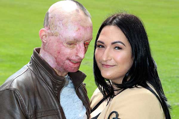 The Real beauty and the beast. Yang penting cinta dan saling mengasihi. foto: mirror.co.uk