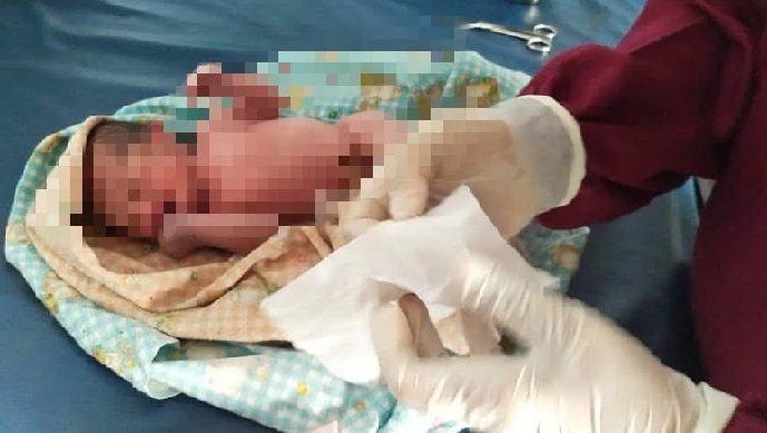 Kondisi bayi yang ditemukan terbungkus daun pisang di Desa Ngoran, Blitar.