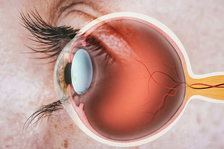 Apakah Diabetes dapat Menyebabkan Kebutaan? Simak Penjelasannya. Foto: Ist