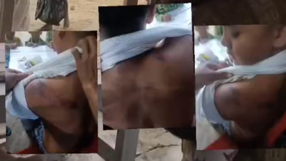Tangkapan layar video memperlihatkan kondisi korban yang mengalami luka usai mengalami penganiayaan