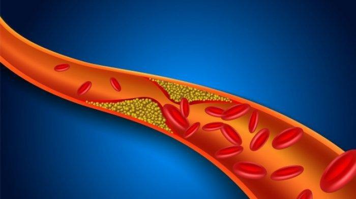 The Truth About Cholesterol Levels and Eggs: What Cholesterol Sufferers Should Know