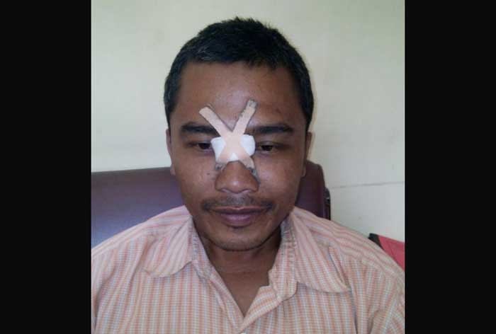 Korban Miftahkhul Arifin mengalami luka di bagian hidung. foto: AKINA/ BANGSAONLINE