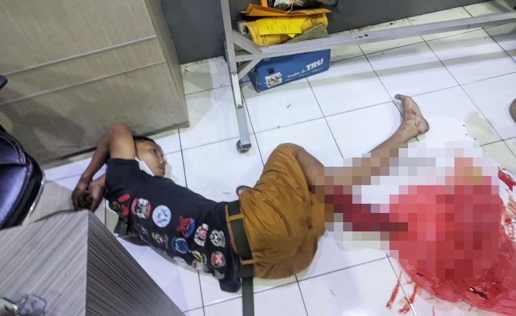Satu dari tiga terduga pelaku tampak tergeletak tak berdaya di Mapolres Jember dengan kaki diperban akibat bekas luka tembakan. 