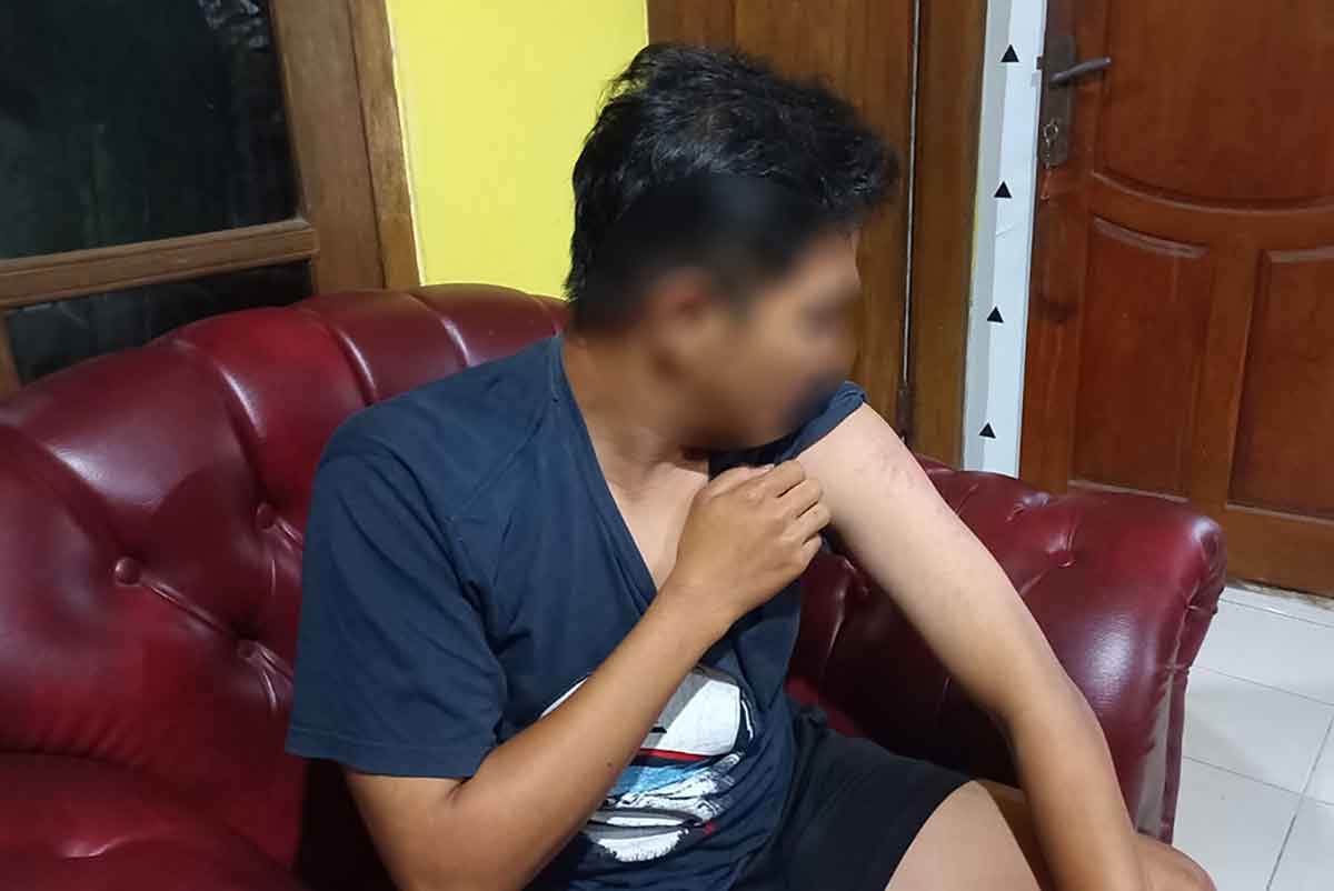 Korban berinisial SI saat menunjukkan luka akibat pengeroyokan oleh puluhan pendekar di Sidoarjo.
