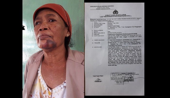Murifah, janda tua yang menjadi sasaran kebrutalan tetangganya sendiri itu masih menyisakan lebam besar di dagunya. Kanan-Lampiran bukti Laporan Polisi (LP) Nomor : LP/243/XII/2017/Jatim Polres Pasuruan Kota tertanggal 13 Desember 2017.