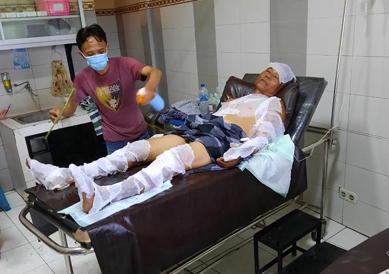 Botol Bensin Eceran Tumpah Kesenggol Cucu, Seorang Kakek Beserta Warkop Miliknya Terbakar