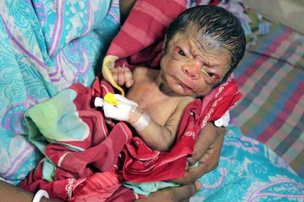sang bayi, meski berwajah manula, namun membuat keluarga bahagia. foto: repro mirror.co.uk