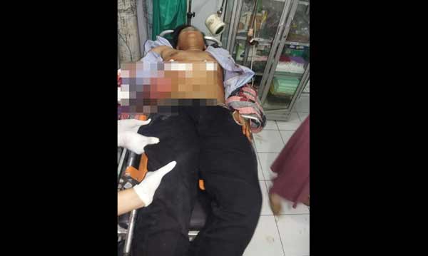 Korban saat dirawat usai dibacok. foto: eko/BANGSAONLINE