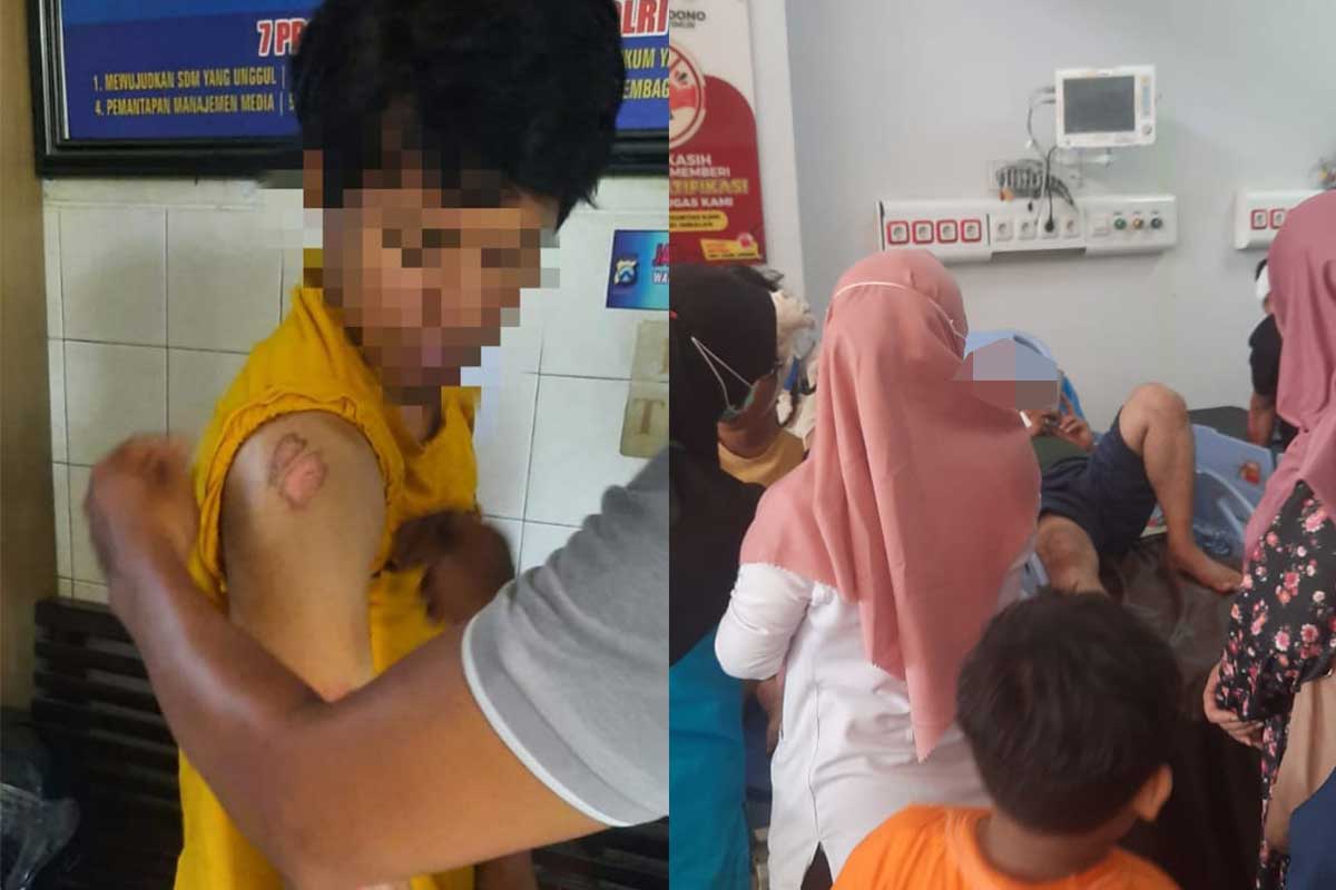 Korban pendemo Bupati Sidoarjo di Gedung KPK Jakarta yang mengalami kecelakaan di Tol Madiun saat perjalanan pulang. 