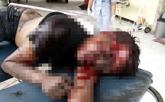 Salah satu pelaku jambret yang babak belur di bawa ke RS Bhayangkara Pusdik Brimob. foto: ANDIK FAKHRUDIN/ BANGSAONLINE